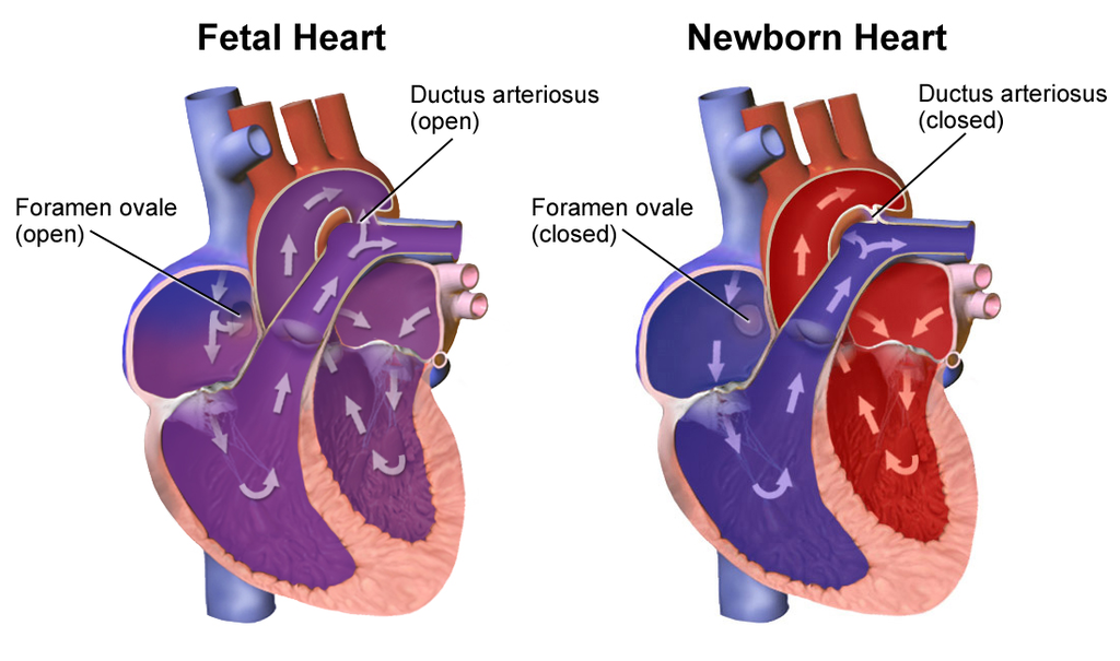 [DIAGRAM] Diagram Of A Fetal Heart - MYDIAGRAM.ONLINE